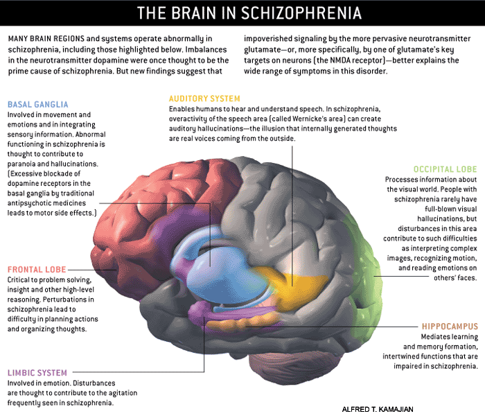 The brain in schizophrenia